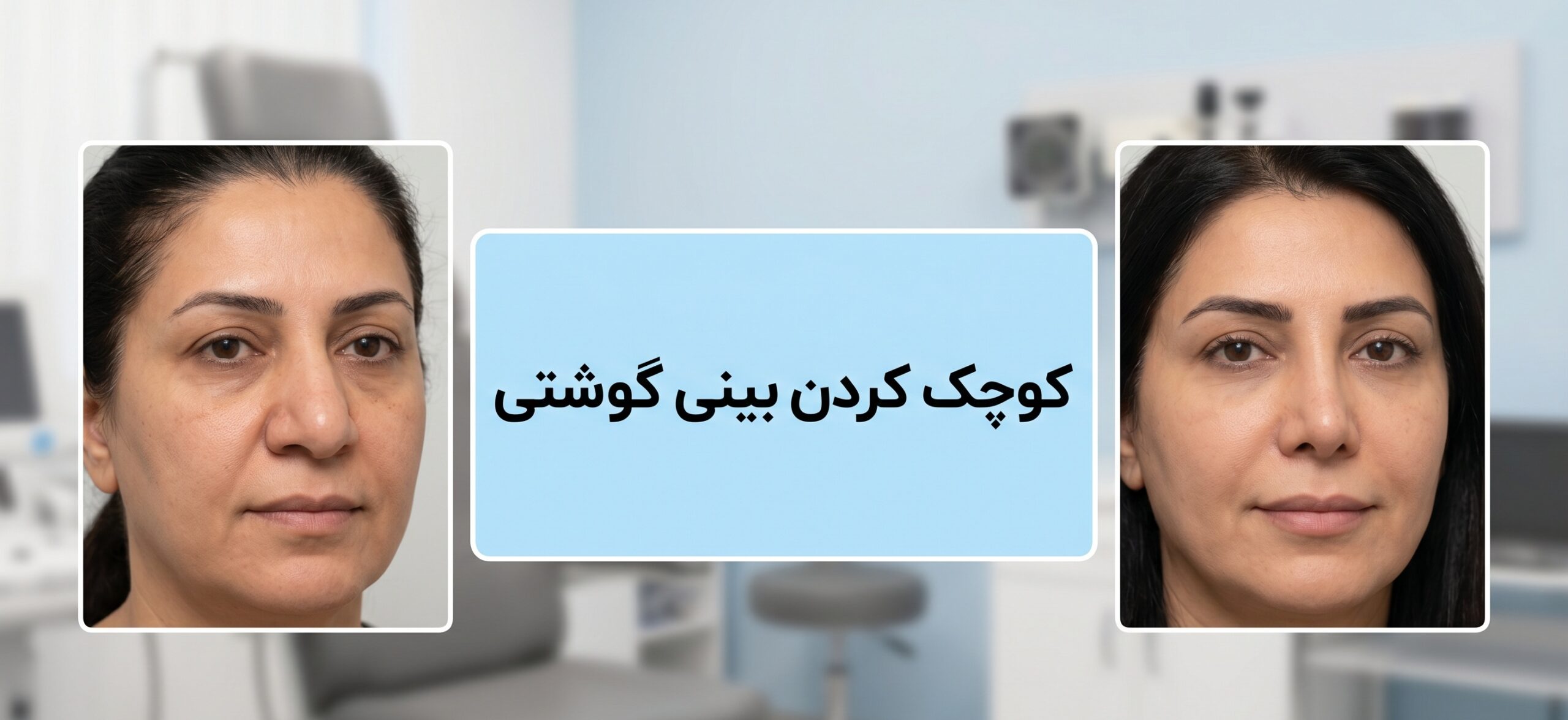 بینی گوشتی را چگونه کوچک کنیم؟ راهنمای کامل روش‌های خانگی و پزشکی