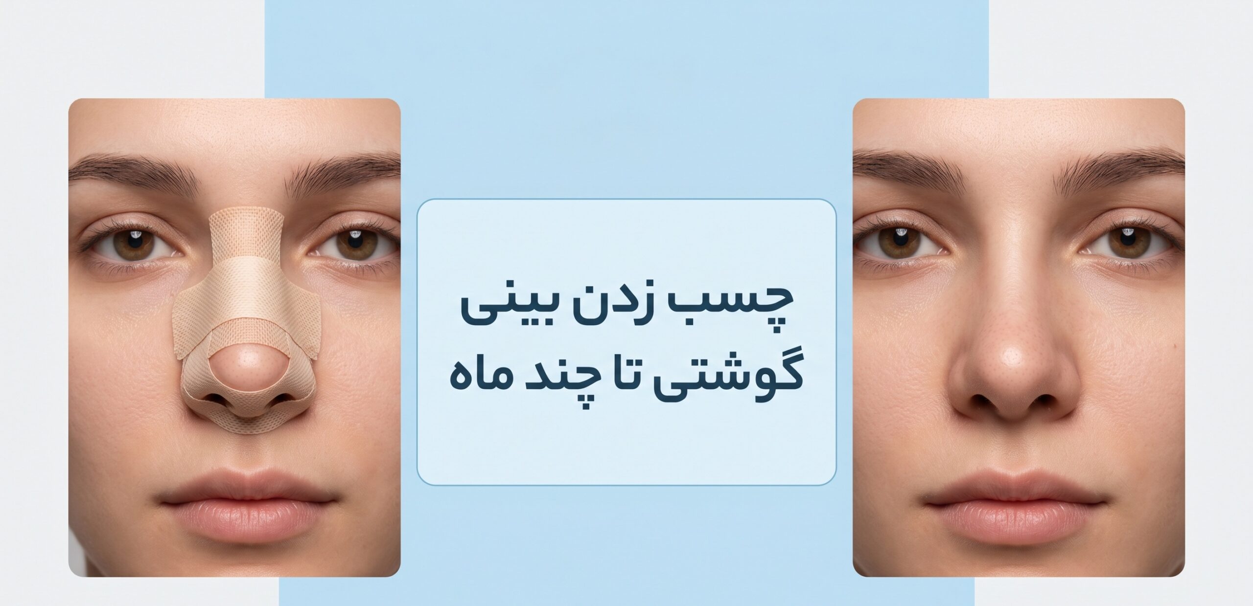 چسب زدن بینی گوشتی تا چند ماه (راهنمای جامع زمان‌بندی و مراقبت)