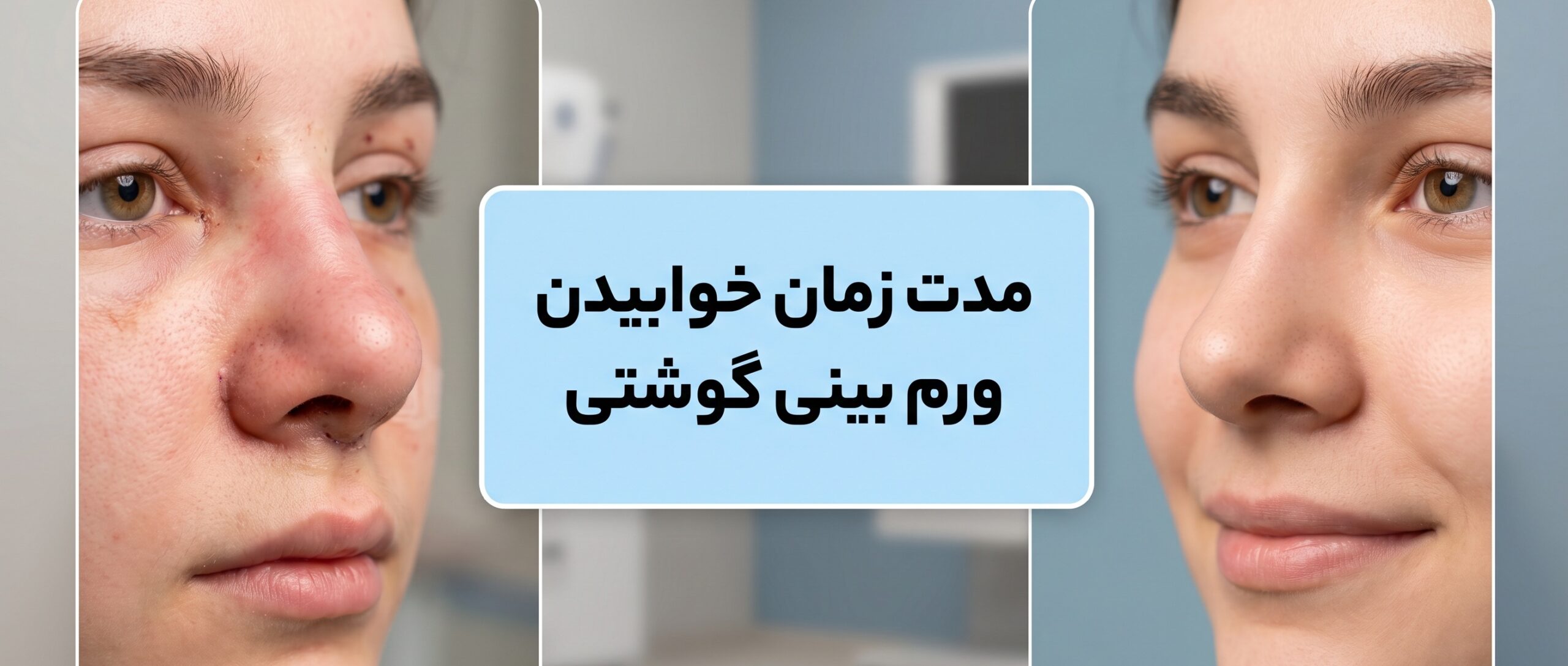 چقدر طول میکشه ورم بینی گوشتی بخوابه؟ راهنمای کامل زمان‌بندی بهبودی-2025